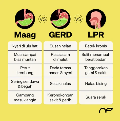 7 Cara Alami Atasi Gejala Maag GERD Tanpa Obat