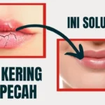 Bibir Kering