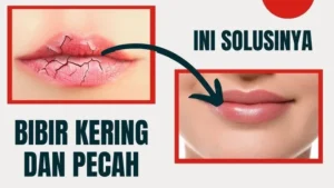 Bibir Kering