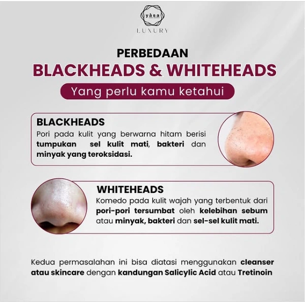 Blackheads dan Whiteheads