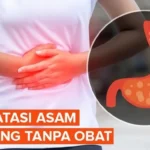 Asam Lambung Naik