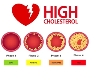 Kolesterol Tinggi