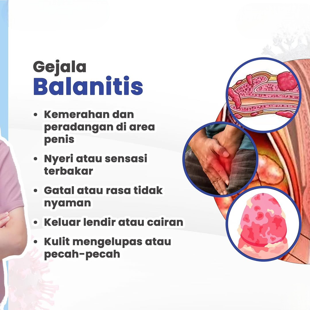 Gejala Balanitis